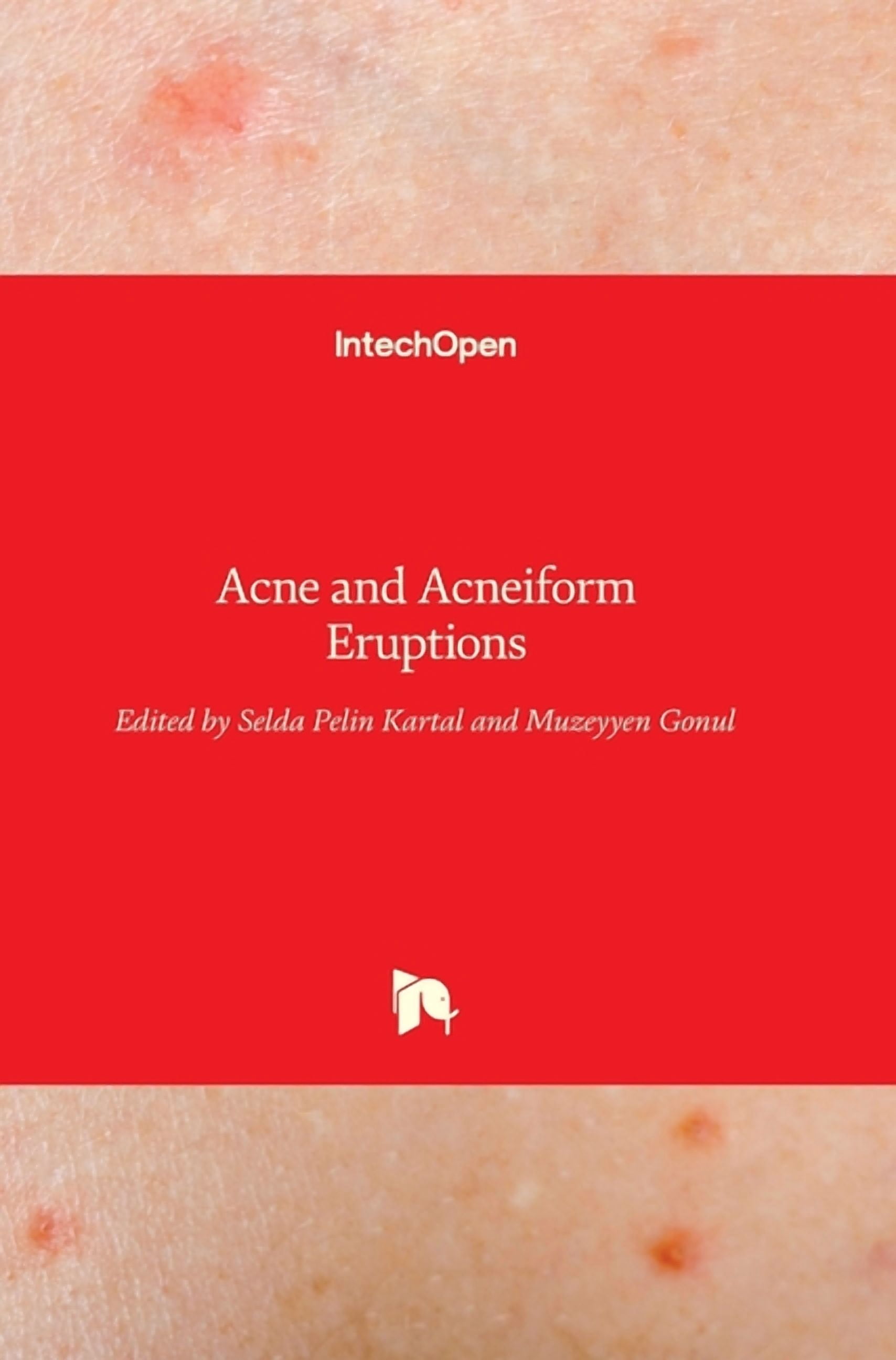 Acne and Acneiform Eruptions (Hardcover) - Walmart.com