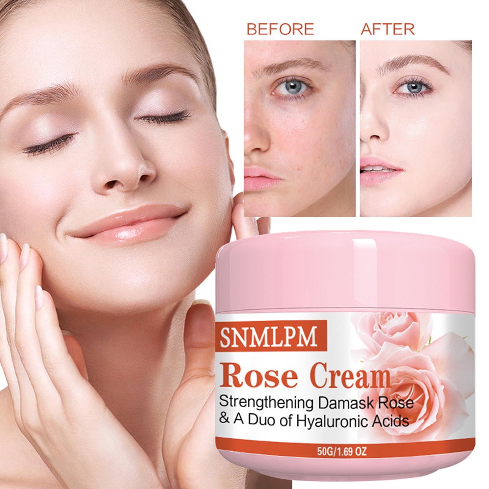 Acnes Removal Ointment And Cream Acnes Mark And Acnes Removal Cream