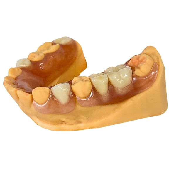 Acrylic Partial Denture – Custom Acrylic & Flexible Options for Up to 8 Randomly Missing Teeth