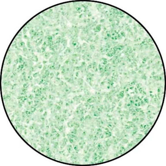 Acurel LOVAC2510 10 x 18 in. Phosphate Infused Media Pad