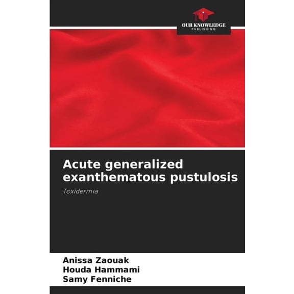 Acute generalized exanthematous pustulosis, (Paperback)