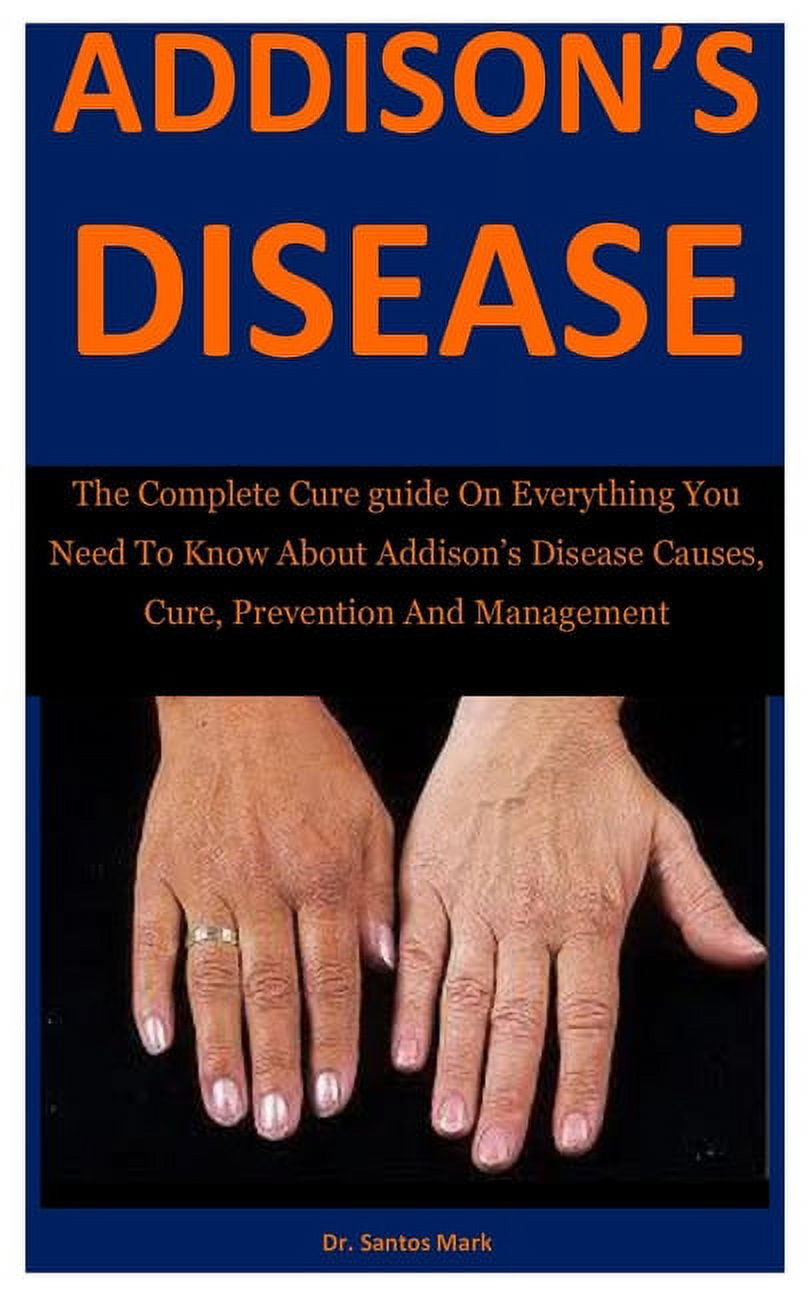 Addison's Disease The Complete Cure guide On Everything You Need To