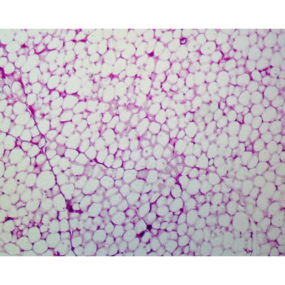 Slide, Adipose Tissue, Human; Section