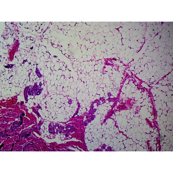 Slide, Adipose Tissue, Mammalian; Section; H&E Stain