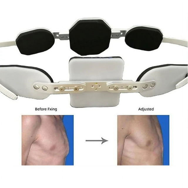 Adjustable Pectus Carinatum Orthosis Brace Pigeon Chest Orthosis