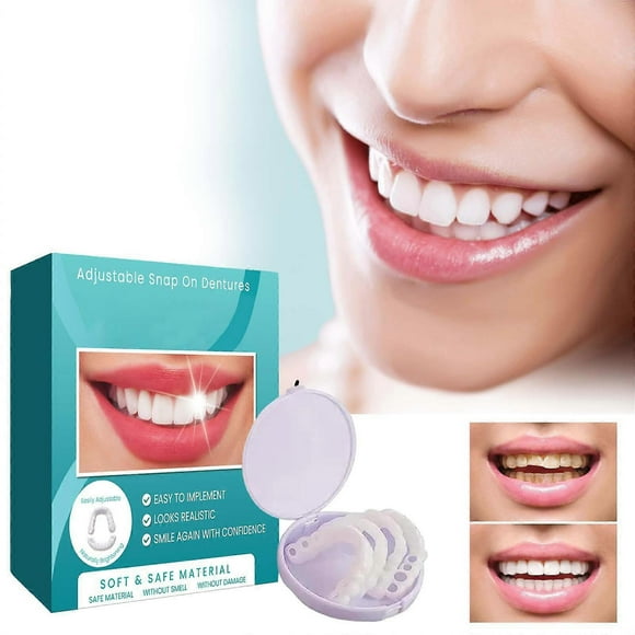 Adjustable Snap-on Dentures, Temporary Fillings Braces Interdental Fillings Straightening Dentures Kit, Veneers Denture Braces Plus Denture Cases