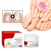 Adpan Clearance! Body Care Grey Nail for Repairing Bright Nails Ingrained Nails Decayed Toenails Hand And Foot Nails Thickening Nail Care 30G 1*Care Cream