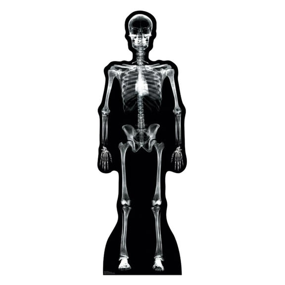 X-Ray Skeleton