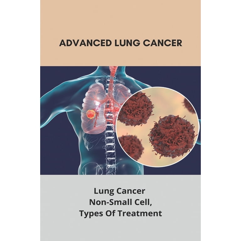 Pdf Treatment Of Advanced Non Small Cell Lung Cancer