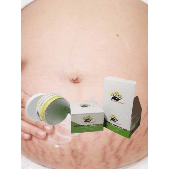 Advanced Stretch Marks & Scars Removal Cream