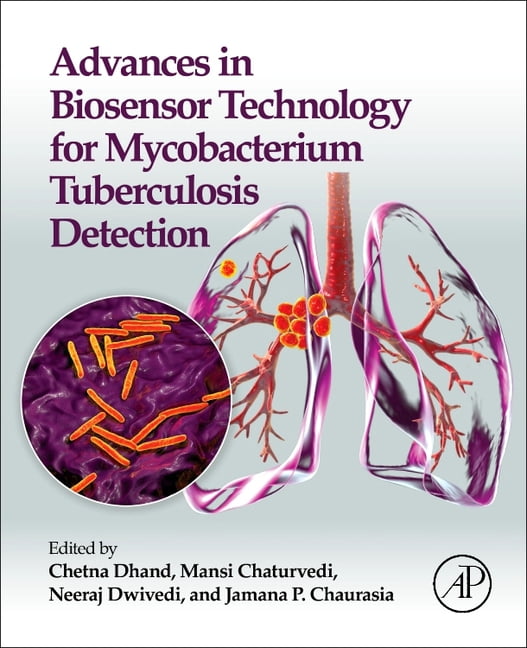 Advances in Biosensor Technology for Mycobacterium Tuberculosis Detection, (Paperback)