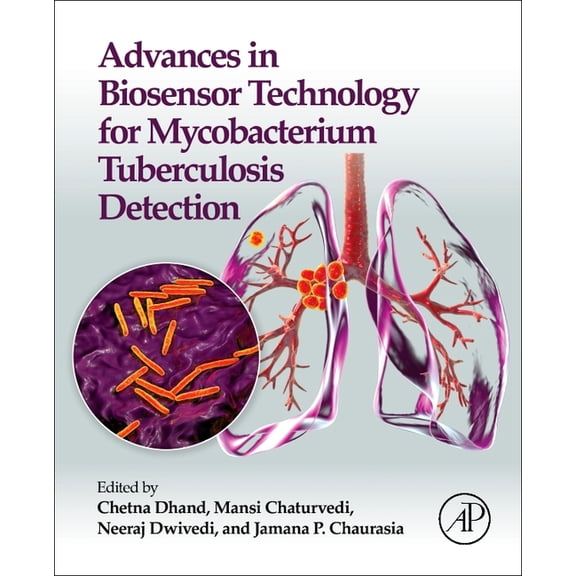 Advances in Biosensor Technology for Mycobacterium Tuberculosis Detection, (Paperback)