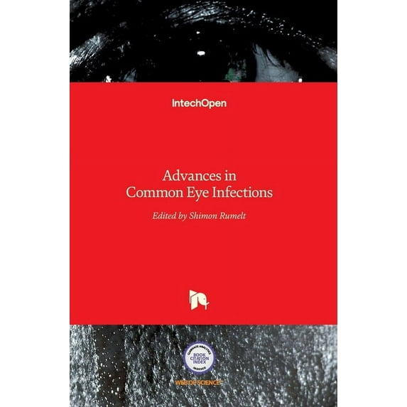 Advances in Common Eye Infections (Hardcover)
