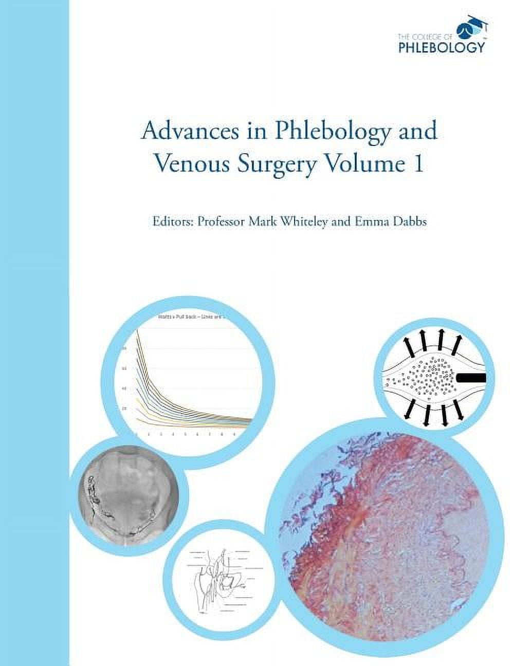 Advances in Phlebology and Venous Surgery Volume 1 (Hardcover) 