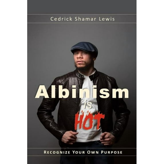 Albinism is Hot!, (Paperback)