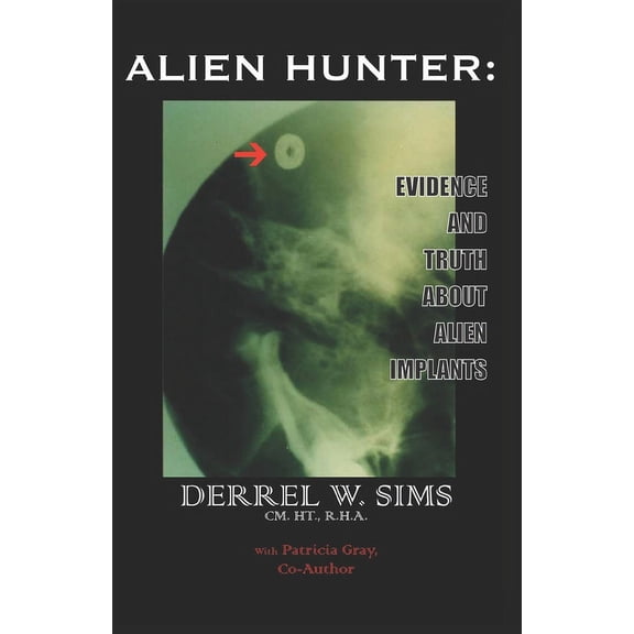 Alien Implants: Evidence & Truth about Alien Implants (Paperback)
