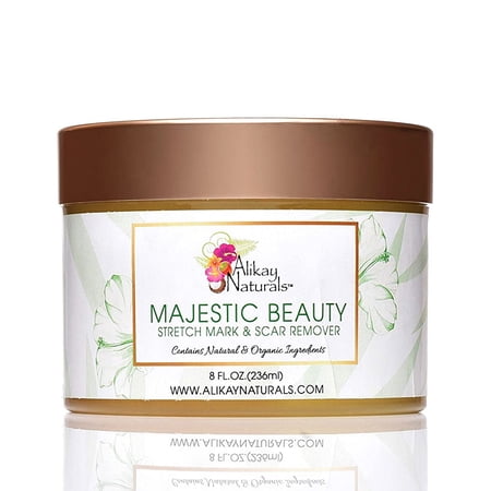 Alikay Naturals Majestic Beauty Stretch Mark And Scar Remover, 8 Oz