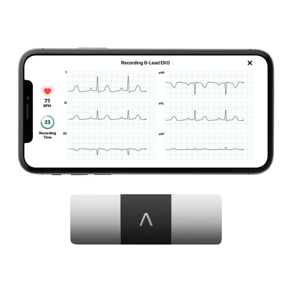 KardiaMobile 6L EKG Heart Monitor | 6-Lead medical grade EKG | Displays EKG on smartphone in 30 seconds, no subscription needed | FSA and HSA eligible