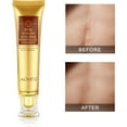 thumbnail image 1 of Aliver Scar Cream - TCM Scar and Acne Mark Removal Gel Ointment for Scars, Burns, Stretch Marks, Acne Spots, Skin Redness Curing, 1 of 7