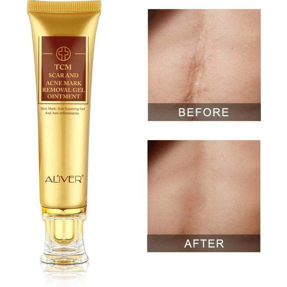 Aliver Scar Cream - TCM Scar and Acne Mark Removal Gel Ointment for Scars, Burns, Stretch Marks, Acne Spots, Skin Redness Curing
