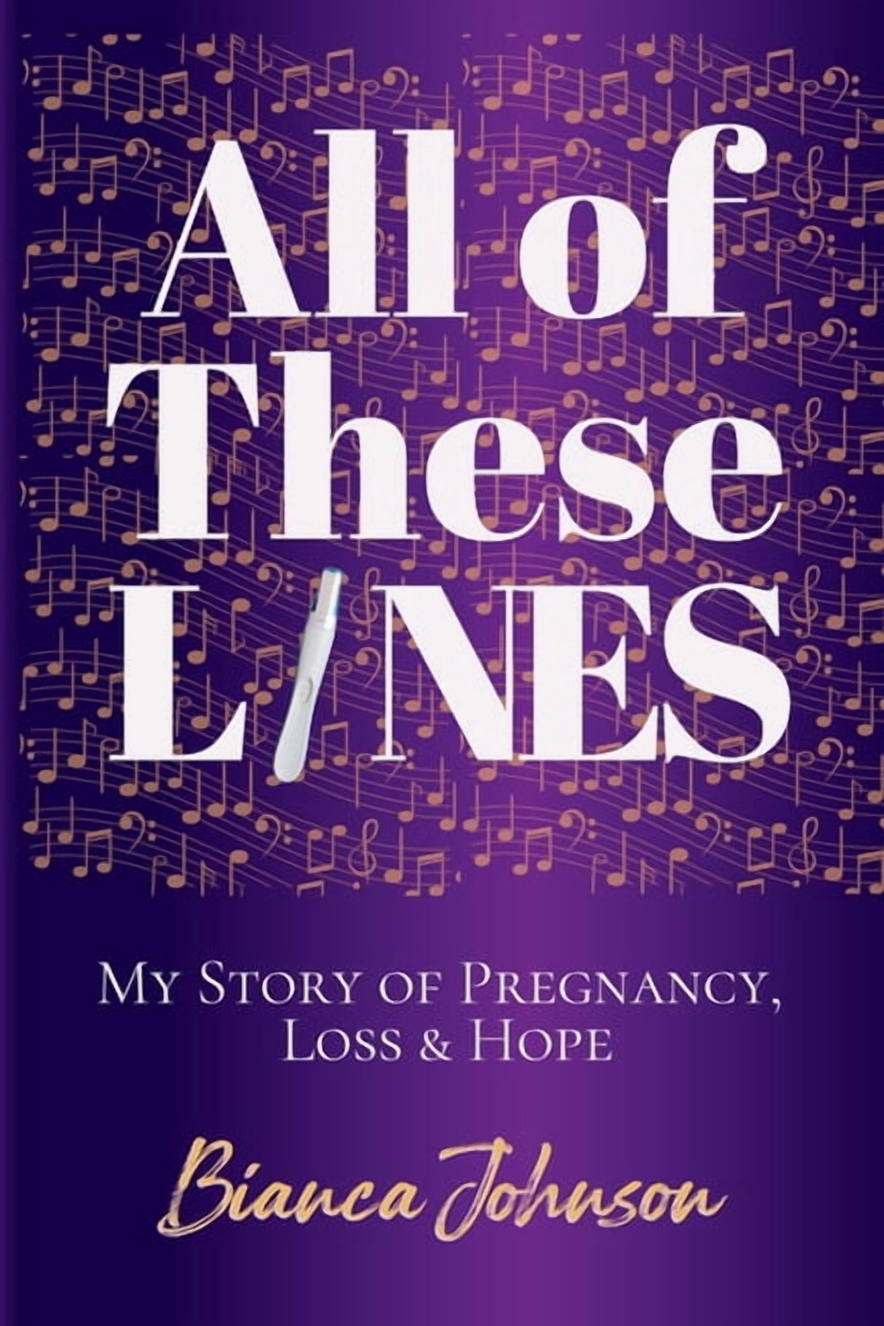 All of These Lines: My Story of Pregnancy, Loss and Hope, (Paperback)