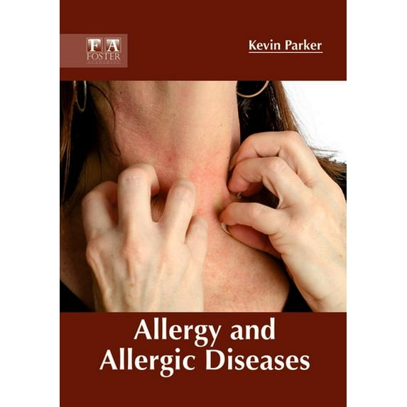 Allergy and Allergic Diseases, (Hardcover)