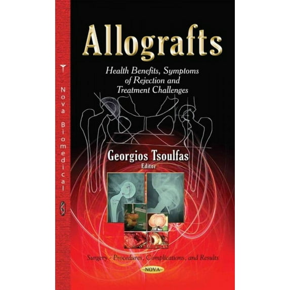 Allografts : Health Benefits, Symptoms of Rejection and Treatment Challenges