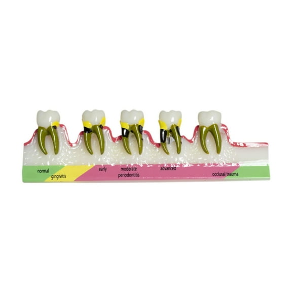 Almencla Demonstration Tooth Model Education Standard Tooth for School Classroom B