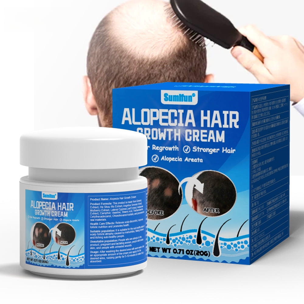 Alopecia Areata Cream Relieves Hair Loss and Activates Hair