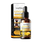 Alopecia Growth Serum Ginger Hair Nuterent Solution - Hair Grow Anti Hair Loss Anti Hair Thinning