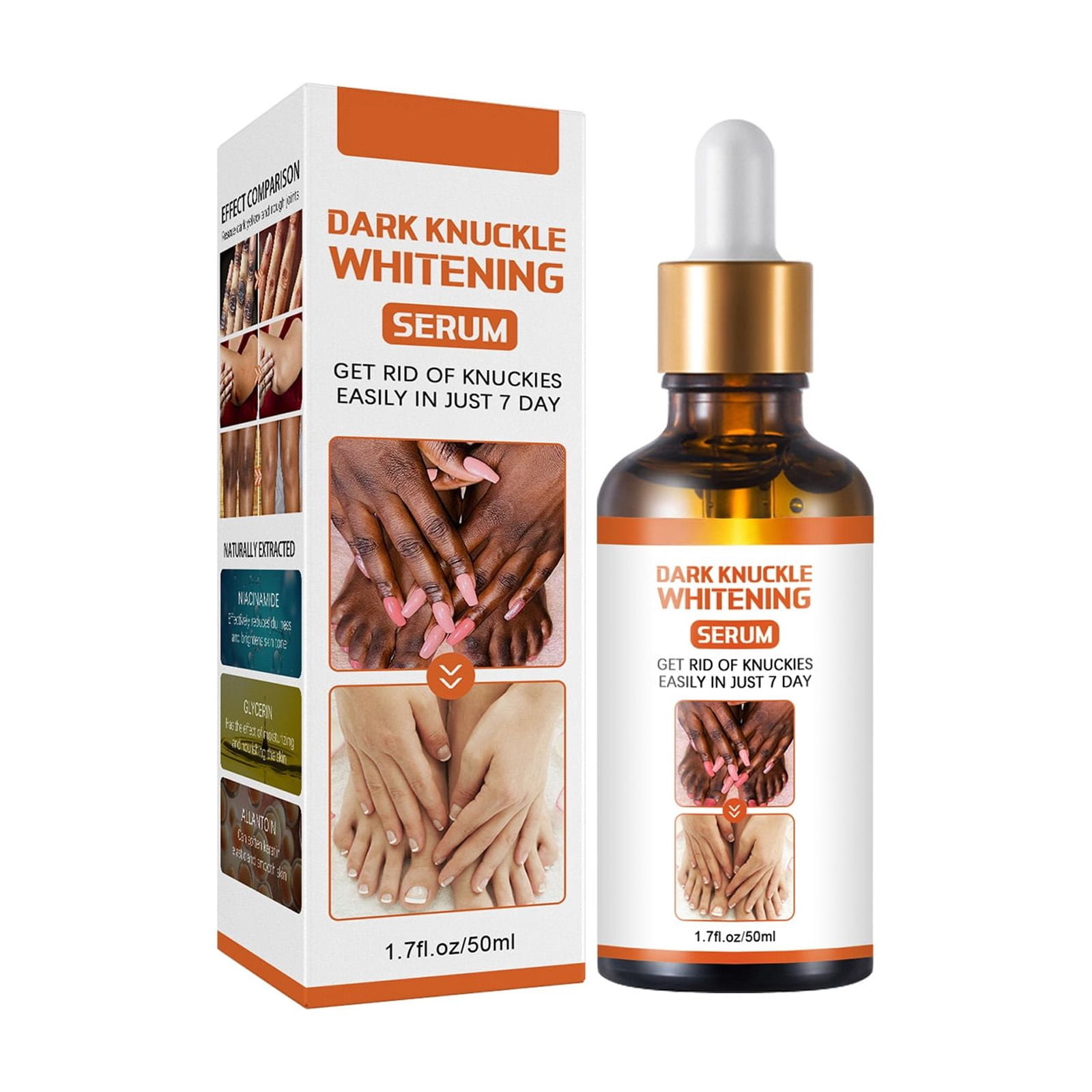 Alvantor Dark Spot Corrector for Hands & Body, Lightening Serum for Dark Knuckles, 1.7 fl oz