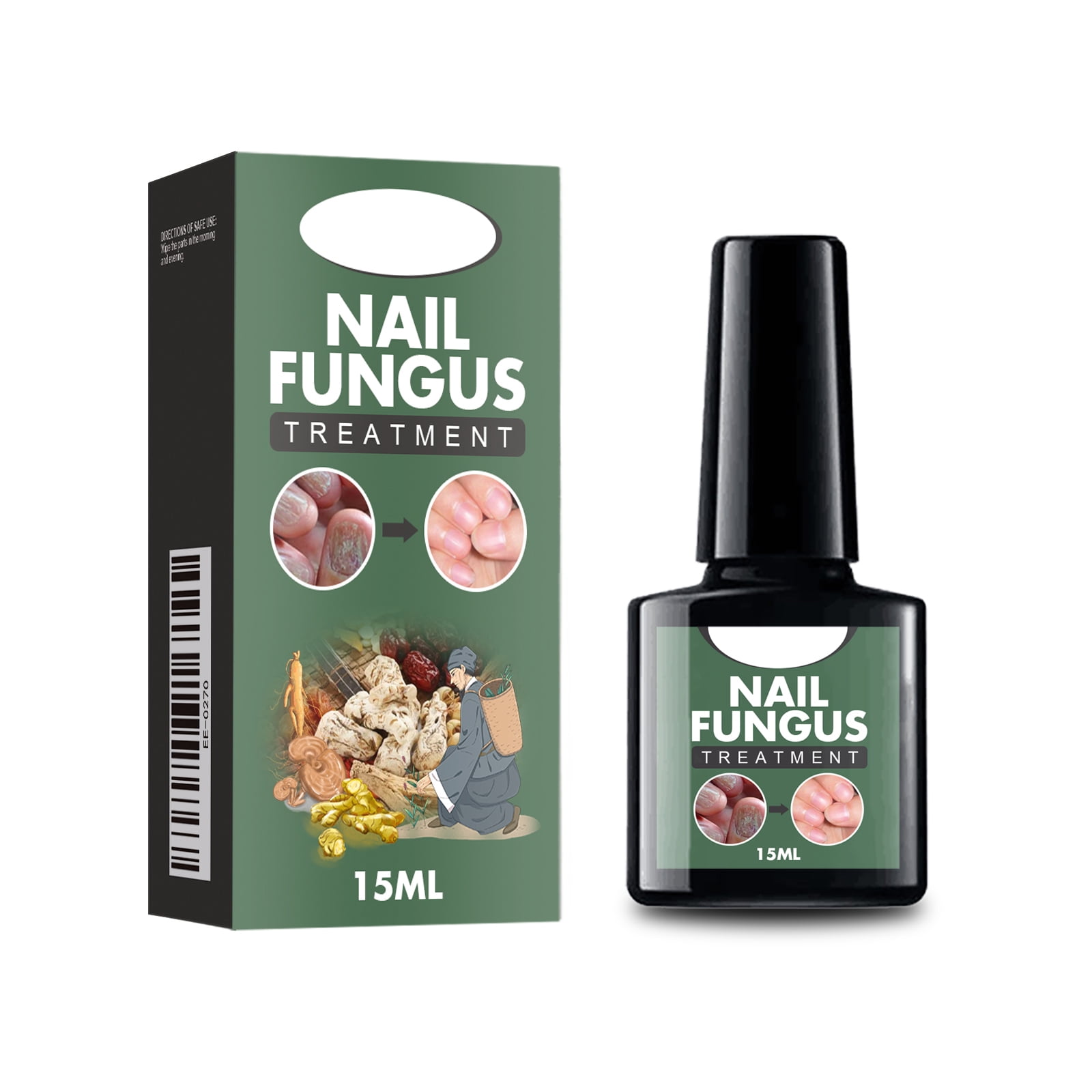 Alvantor Nail Fungus Treatment Solution for Thickened and Softened Damaged Nails, 0.5fl oz