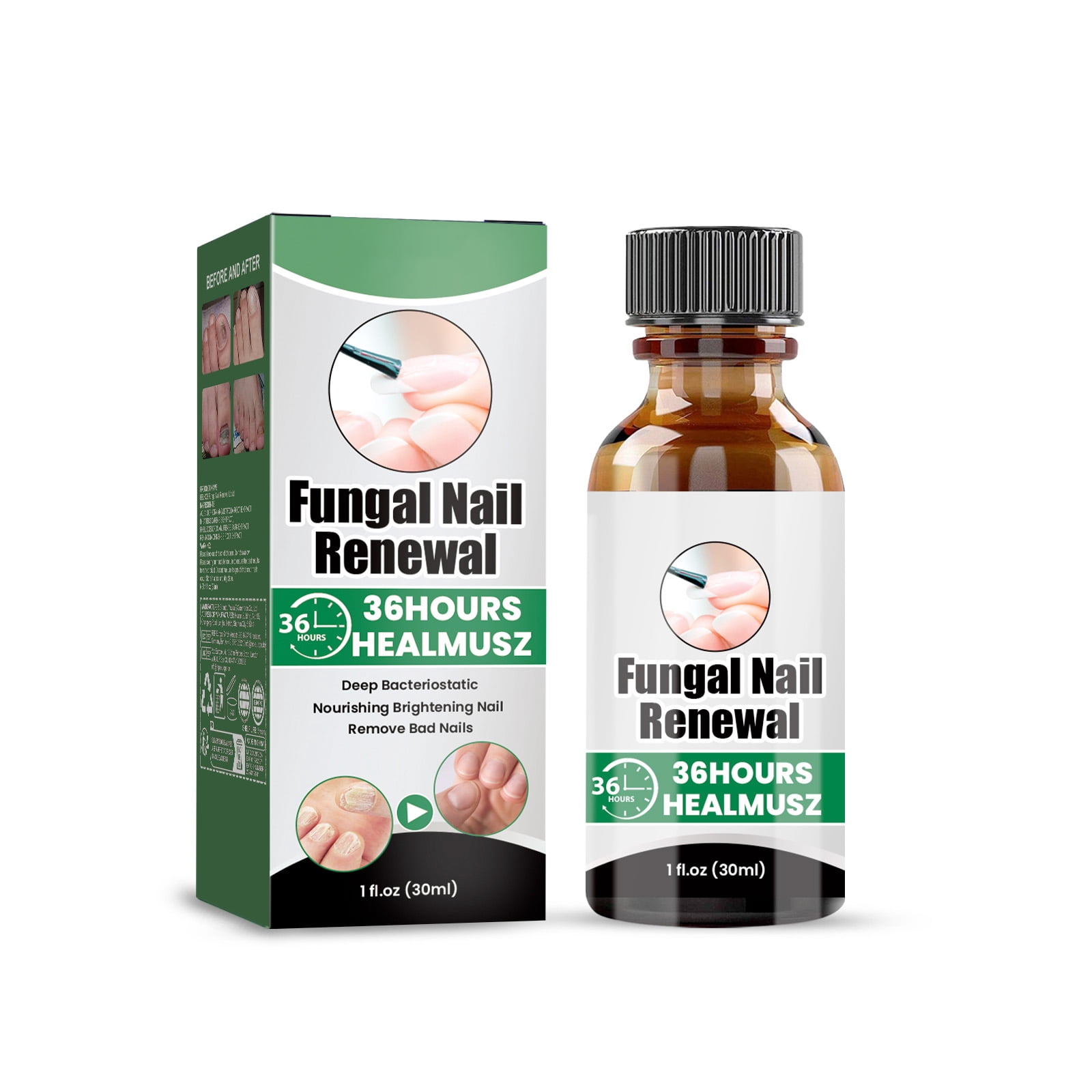 Alvantor Nail Repair For Fungal Treatment, Gray Removing Nourishing Lotion For Hands and feet, 1 fl oz