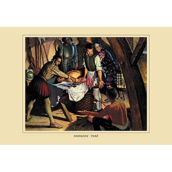 Ambroise Pare- Fine Art Canvas Print (20" x 30")