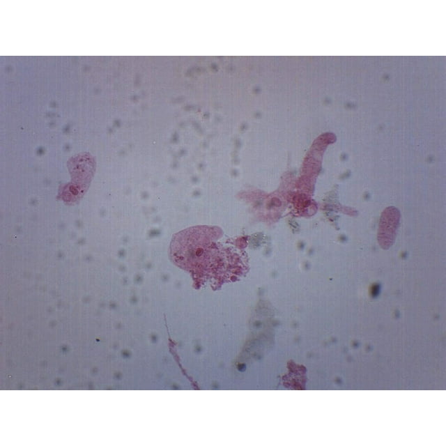 Amoeba Proteus, Whole Mount Prepared Microscope Slide 75 X 25Mm