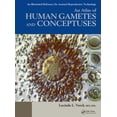 thumbnail image 1 of Pre-Owned An Atlas of Human Gametes and Conceptuses: An Illustrated Reference for Assisted Reproductive Technology (Hardcover) 1850700168 9781850700166, 1 of 2