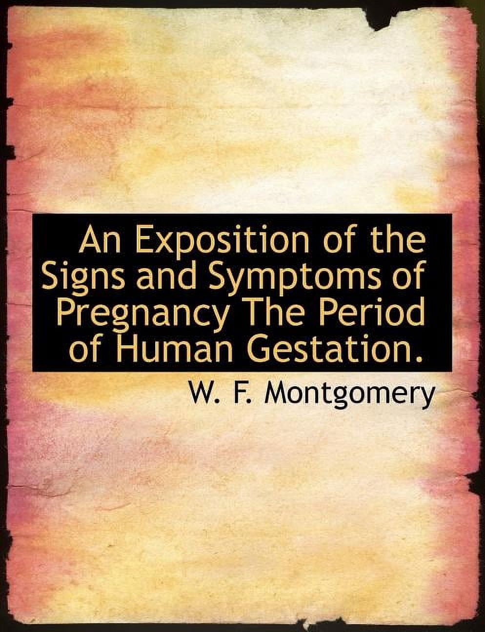 An Exposition of the Signs and Symptoms of Pregnancy the Period of Human Gestation. (Paperback)