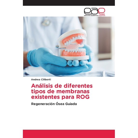 AnÃ¡lisis de diferentes tipos de membranas existentes para ROG, (Paperback)