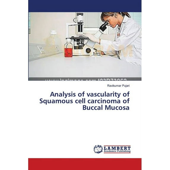 Analysis of vascularity of Squamous cell carcinoma of Buccal Mucosa (Paperback)