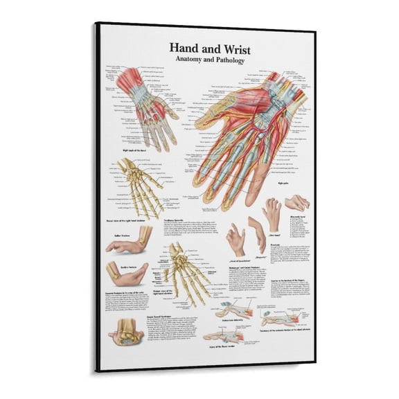 Anatomical Poste Hand And Wrist Anatomy And Pathology Posters Poster Decorative Painting Canvas Wall Art Living Room Posters Bedroom Painting 11x17inch(28x43cm)