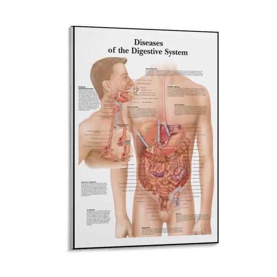 Digestive System Poster Example Anatomical Poster Diseases Of The Digestive System Posters Wall Art ...