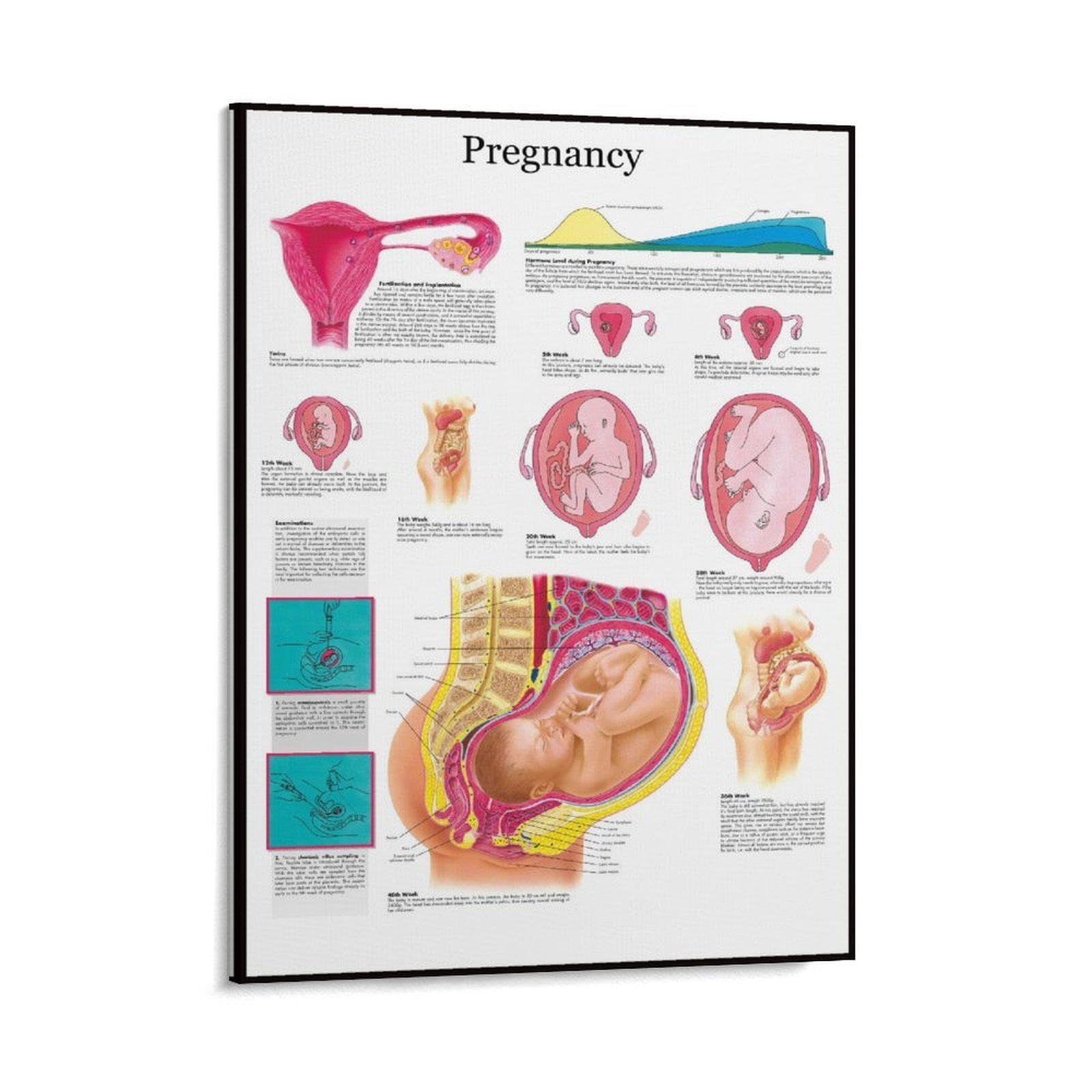 Anatomical Poster Pregnancy Posters Painting On Canvas Wall Art Poster ...