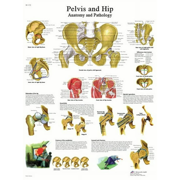 Anatomical chart: hip & pelvis, laminated