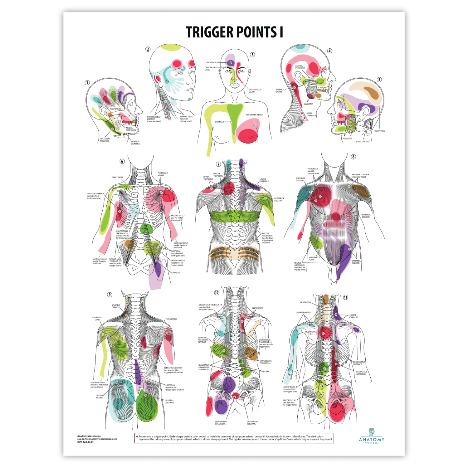 Anatomy Lab Trigger Points I Laminated Poster, 17.3 x 22.5 Inches