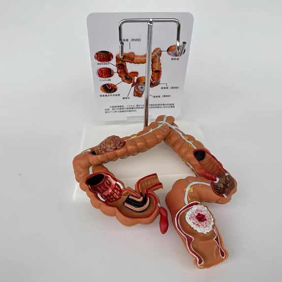 Anatomy and Physiology Study Tools: 3D Colon Model Human Large ...