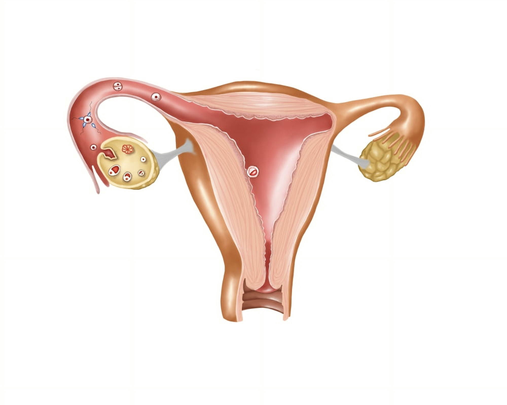 Anatomy of female uterus Canvas Art - Stocktrek Images (32 x 26)