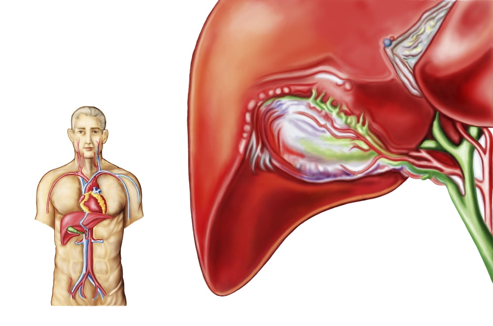 Anatomy of gall bladder ganglion Canvas Art - Stocktrek Images (34 x 23)