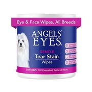 Angel s Eyes Tear Stain Wipes for Dogs & Cats, 100 Count   Gentle Presoaked Textured Pads AEGTSW100