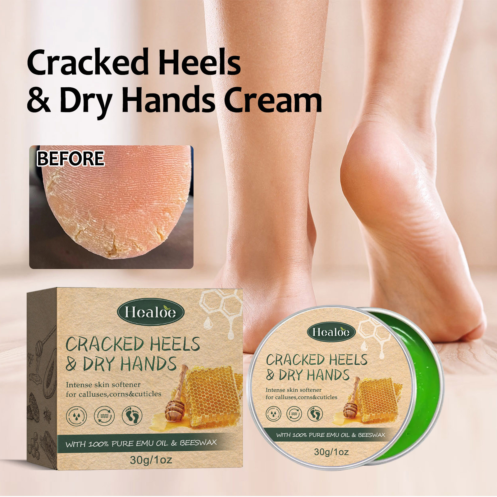 AntiCracking Hand & Foot Cream, Deeply Moisturize The Skin Of Hands