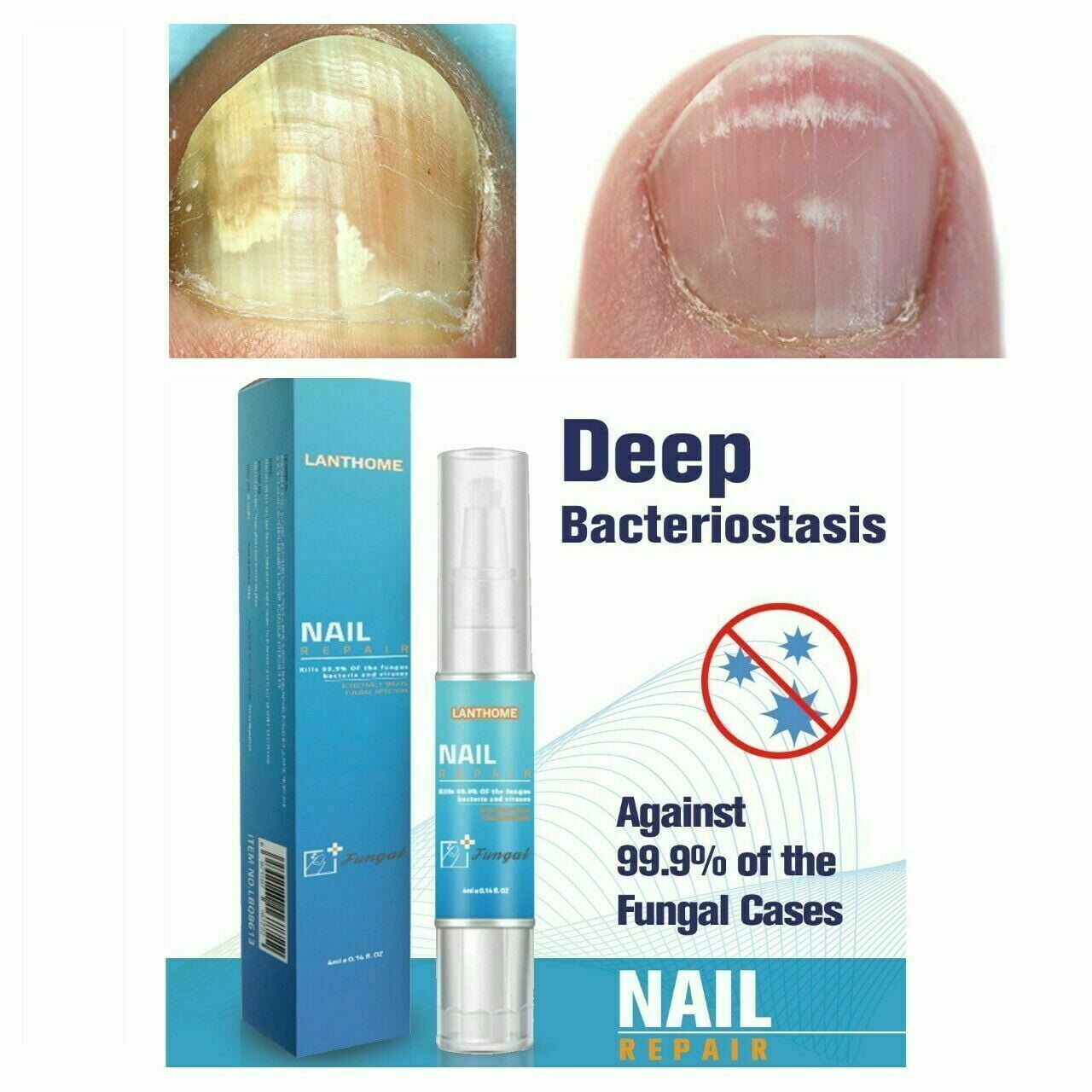 AntiFungal Liquid Solution,Toenail Fungus Treatment Extra Strength for Toenail & Fingernails